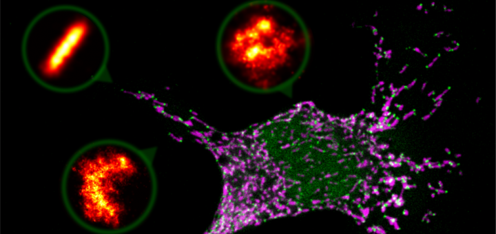 Bax assembly into rings and arcs in apoptotic mitochondria is linked to membrane pores. EMBO J. 2016 Feb 15;35(4):389-401. doi: 10.15252/embj.